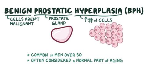 Benign Prostatic Hyperplasia Video Anatomy Osmosis