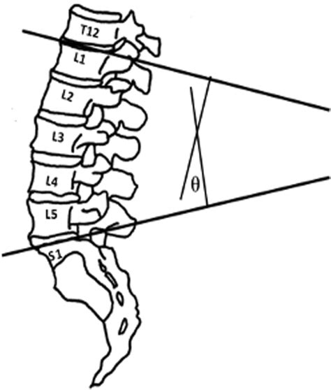 Method Of Calculating The Lumbar Spine Angle From Posteroanterior Plain