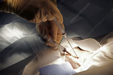 Heart Surgery Stock Image M5600420 Science Photo Library