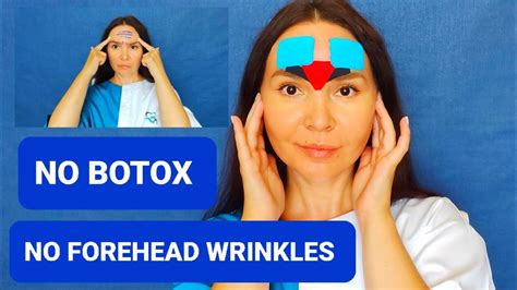 How To Get Rid Of Deep Forehead Wrinkles Overnight Naturally