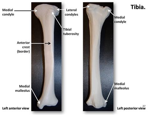 Tibia Anterior And Posterior Views With Labels Appendic Flickr