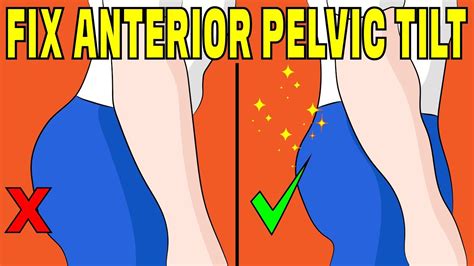 A positive contact will result in a 'tug back' of the shim stock and a negative contact. How to fix anterior pelvic tilt without any equipment ...