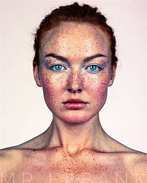 Fotógrafo Retrata A Beleza única De Pessoas Com Sardas