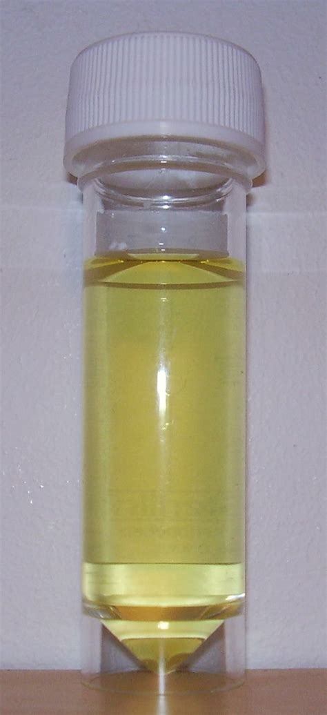 urine wikidoc