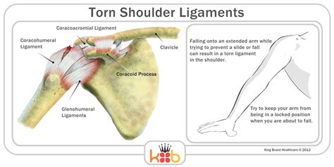 Torn Ligament Injury Treatment