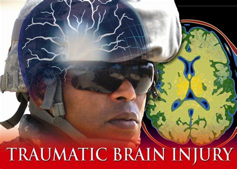 March Marks Tbi Awareness Month Air Force Medical Service News
