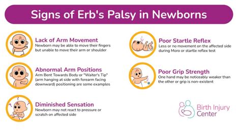 Erbs Palsy Symptoms Birth Injury Center