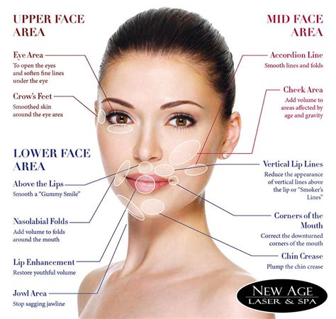 Juvederm Dermal Fillers – New Age Laser & Medical Clinic