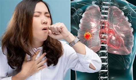 Lung Cancer Symptoms Signs Of Tumour Include Persistent Cough And