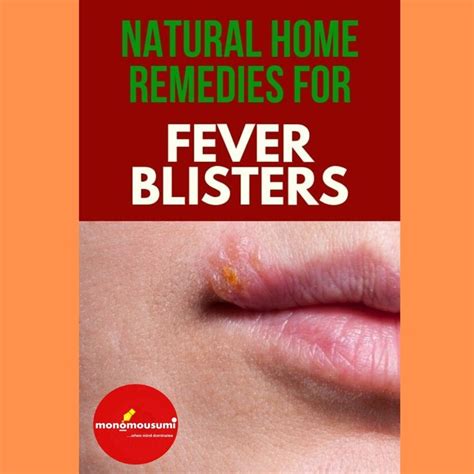 natural home remedies to treat a fever blister fever blister fever blister remedy fever