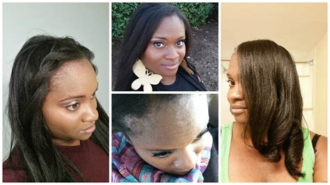 Hair Salons Specializing In Alopecia Near Me Beauty And Health