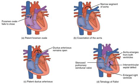 Ductus Arteriosus Vs Ductus Venosus Vs Foramen Ovale Fetal Heart
