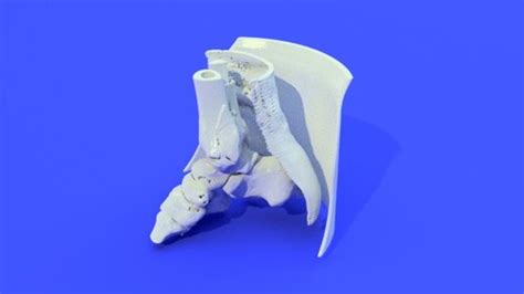 Bones Stl File Processed Extremity Lower Leg