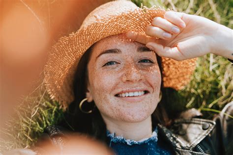 Exploring The Science Behind Freckles And Moles Understanding The Differences And Risk Factors