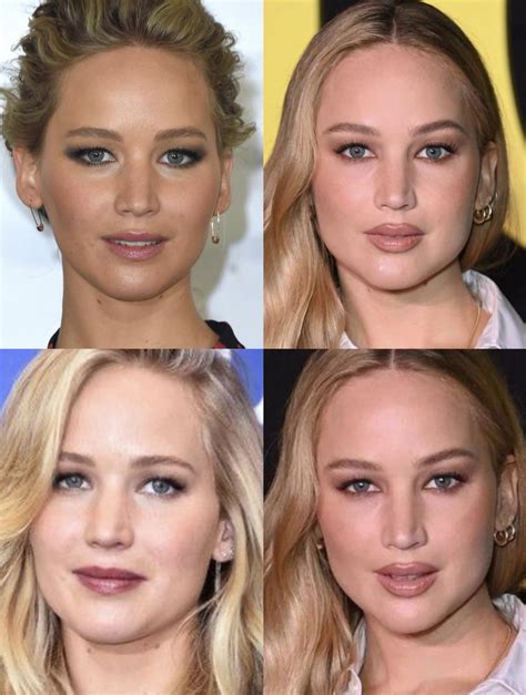 Jennifer Lawrence Plastic Surgery Before And After Photos My Xxx Hot Girl