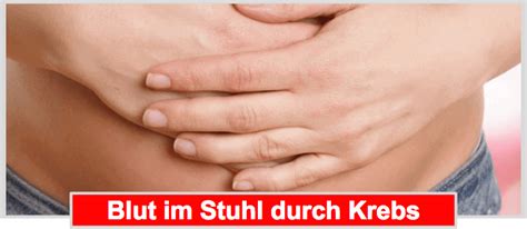 Blut im stuhl ist niemals ein normalzustand: WARNUNG ᐅ Blut im Stuhl - Direkt zum Arzt oder abwarten?