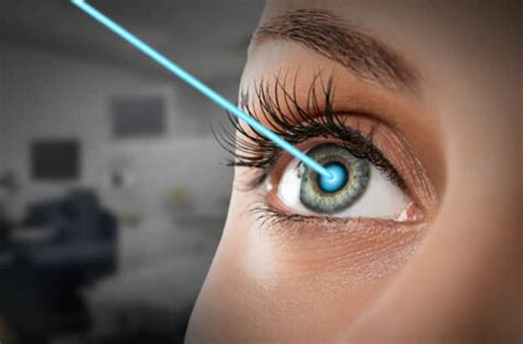 Laser Eye Surgery DERMABARE Med Spa