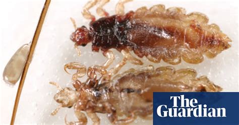 The Inside Track On Head Lice Health And Wellbeing The Guardian