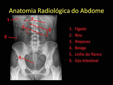 Anatomia Radiologica Del Abdomen Images And Photos Finder