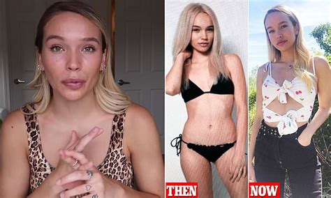Former Model Who Was Put On A Forced Diet By Her Agency Speaks About