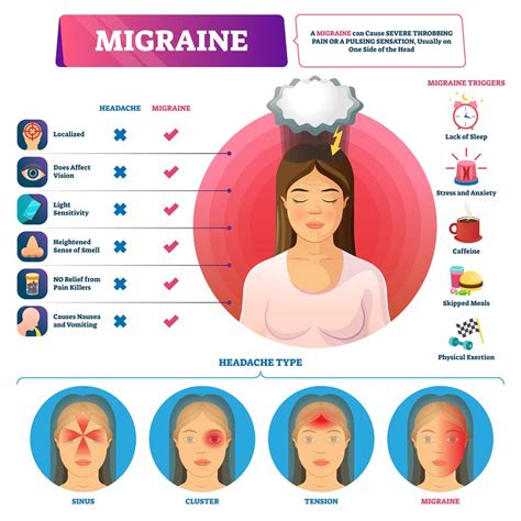 Migraine Headaches The Basics