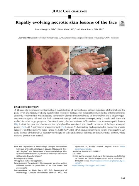 Pdf Rapidly Evolving Necrotic Skin Lesions Of The Face