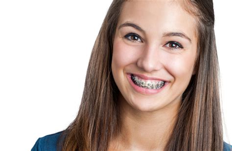 metal braces london harley street braces origin orthodontics