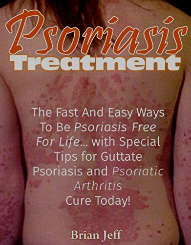 Psoriasis Treatment The Fast And Easy Ways To Be Psoriasis Free For