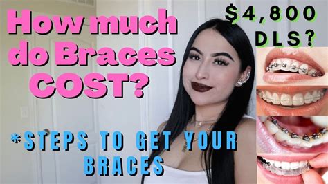 Braces How Much Do Braces Cost Approx Expensive Orientation