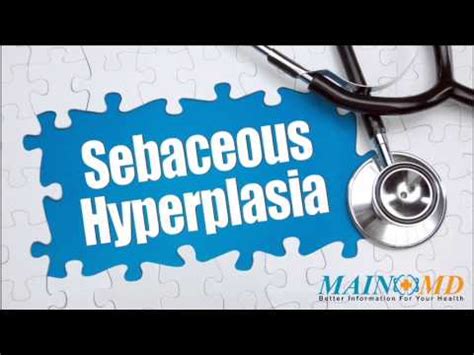 The condition is characterized by the development of a however, if choosing to look for treatment options, the best route would depend largely on the symptoms that accompany the condition. Sebaceous hyperplasia ¦ Treatment and Symptoms - YouTube