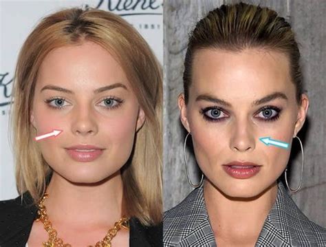 Most Popular Celebrity Nose Jobs Before And After With Images Fabbon