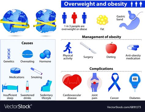Obesity Infographics Royalty Free Vector Image