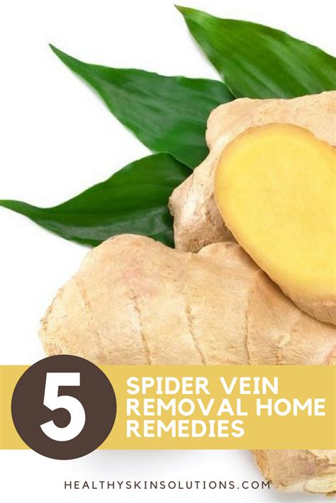 5 Spider Vein Removal Home Remedies That Work Natural Skin