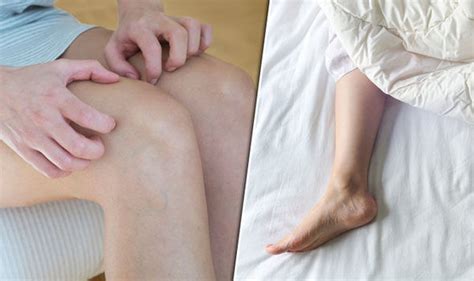 Restless Leg Syndrome Symptoms Condition That Causes Tingling Toes
