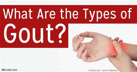 What Are The Types Of Gout