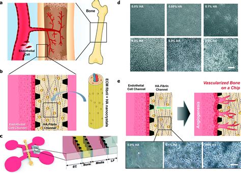 Microfluidic Vascularized Bone Tissue Model With Hydroxyapatite