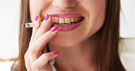 smokers teeth how to remove smoking stains from teeth