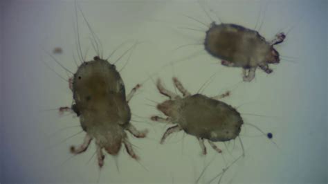 Dust Mites Under The Microscope Youtube