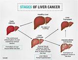 Poor Liver Health Symptoms Images