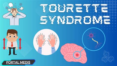 Apa Itu Sindrom Tourette Kenali Gejala Penyebab Dan Pengobatan Portal Medis Portal