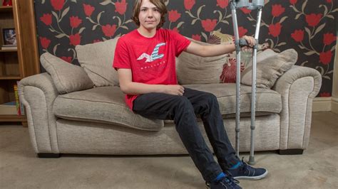 Brave Teen Throws Leg Leaving Party As He Prepares To Have Arthritic