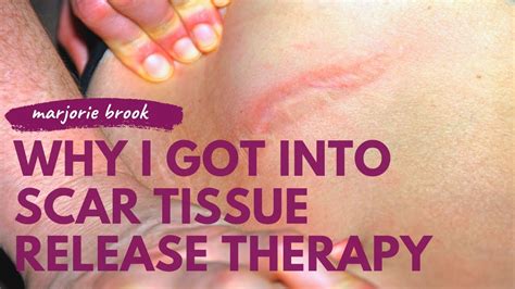 Why I Got Into Scar Tissue Release Therapy Marjorie Brook Lmt Youtube