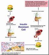 Pictures of Insulin Resistance Mayo Clinic