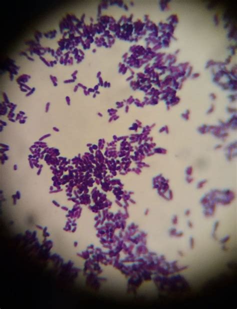 Corynebacterium Pseudotuberculosis Red Peppercorn Microbiology
