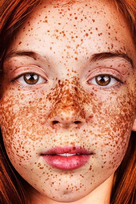 Photos Of People With Freckles Popsugar Beauty