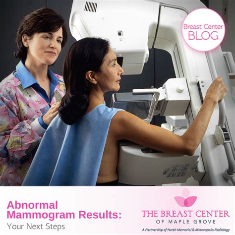 Abnormal Mammogram Results Your Next Step Minneapolis Radiology