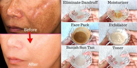 Diy Facial Scrub To Lighten Pigmentation