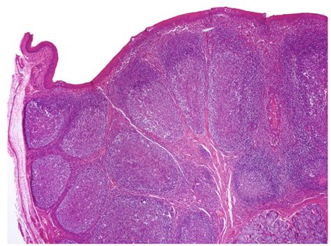 Lymphatic Palatine Tonsil Histology Diagram Quizlet The Best Porn Website
