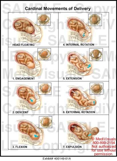 Cardinal Movements Of Delivery Medical Illustration Medivisuals