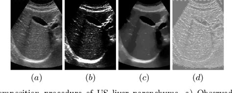 Pdf Diffuse Liver Disease Classification From Ultrasound Surface